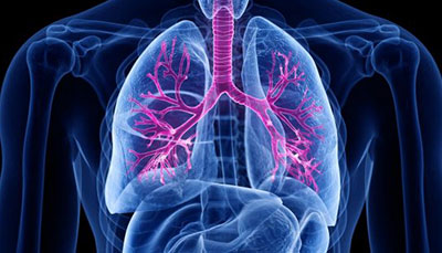 什么是慢性阻塞性肺病 (Chronic Obstructive Pulmonary Disease)，為何與新冠疫情有關(guān)？